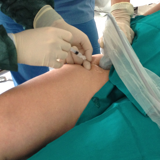 terapia infiltrativa