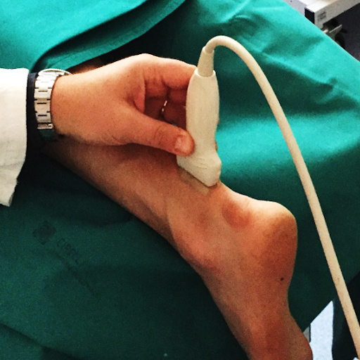 ecografia muscolo scheletrica diagnostica e interventistica